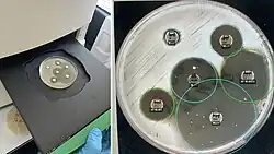 Automated culture plate reader to measure inhibition zone diameters