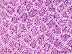 Cross-section histology of intestinal villi of the human terminal ileum.