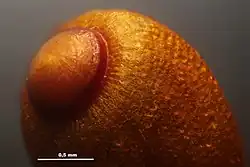 Tip of sporangium (capsule) showing the well-defined annulus of Funaria.