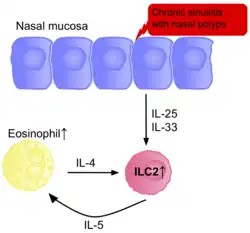 A diagram of the nasal mucosa, an ILC2 cell, and an eosinophil cell, with arrows displaying their interactions with one another, and how these interactions cause allergic rhinitis.