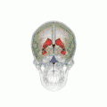 Position of lateral ventricles (shown in red)