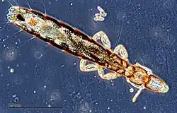 Columbicola columbae under a microscope