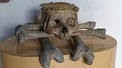 A human skull sitting atop several other human bones in a museum display.