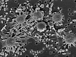 Amoebal and cystic cells of Parvularia atlantis