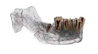 Scan of the mandible (lower jaw)