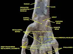 Wrist joint. Deep dissection. Anterior, palmar, view.