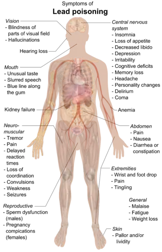 A chart of a human body with arrows pointing pieces of text to different parts of the body