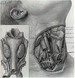 Thyroidectomy procedure - surgical anatomy